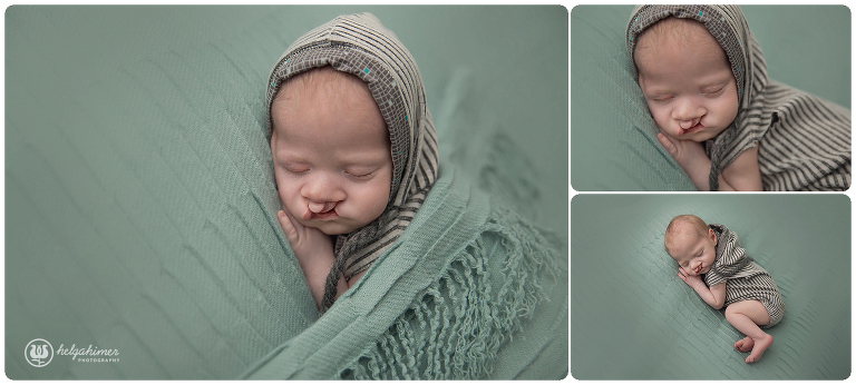 sudbury-photographer-helgahimer-newborn-boy-cleftlip-miajoy-blanketshots-tushyup