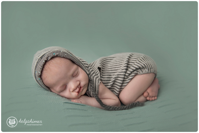 sudbury-photographer-helgahimer-newborn-miajoy-tushy-up-bummup-boy-cleftlip-baby